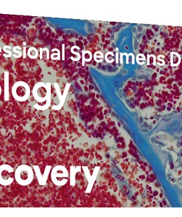  Discovery Prof paraugi DPS 5. “Bioloģija”  Hover